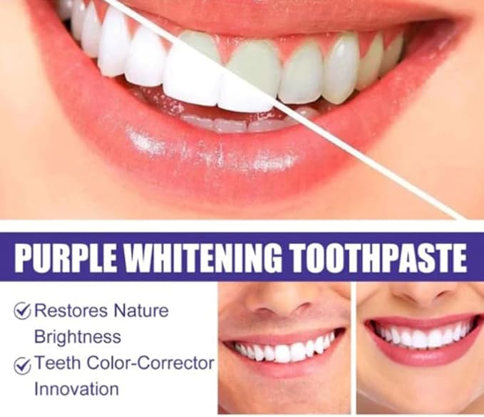 Purple Color Corrector Toothpaste – Instant Teeth Brightening & Whitening Solution