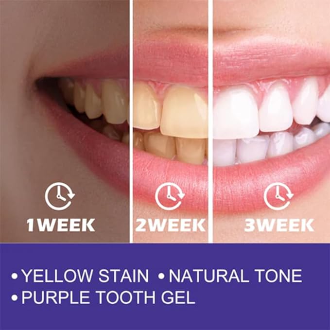 Purple Color Corrector Toothpaste – Instant Teeth Brightening & Whitening Solution